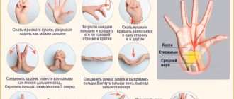 Артроз мелких суставов: как избавиться от боли в руках и стопах